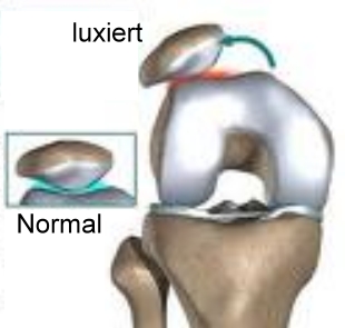 Patella